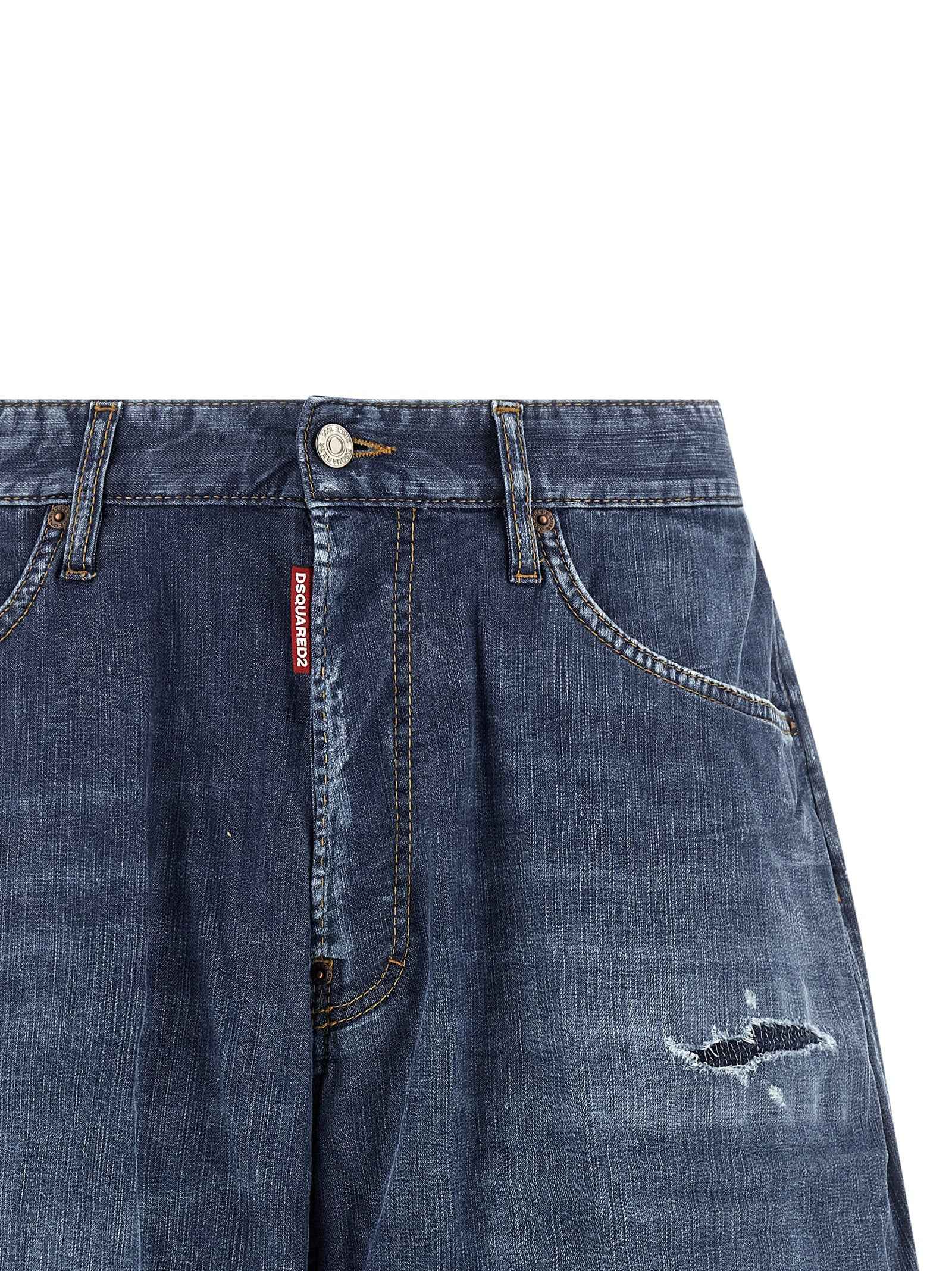 Blue Cotton Bermuda Shorts